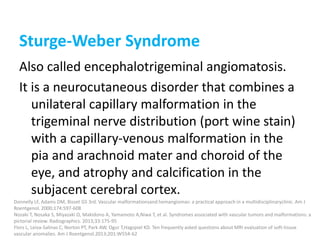 Sturge-Weber Syndrome
Also called encephalotrigeminal angiomatosis.
It is a neurocutaneous disorder that combines a
unilateral capillary malformation in the
trigeminal nerve distribution (port wine stain)
with a capillary-venous malformation in the
pia and arachnoid mater and choroid of the
eye, and atrophy and calcification in the
subjacent cerebral cortex.
Donnelly LF, Adams DM, Bisset GS 3rd. Vascular malformationsand hemangiomas: a practical approach in a multidisciplinaryclinic. Am J
Roentgenol. 2000;174:597-608
Nozaki T, Nosaka S, Miyazaki O, Makidono A, Yamamoto A,Niwa T, et al. Syndromes associated with vascular tumors and malformations: a
pictorial review. Radiographics. 2013;33:175-95
Flors L, Leiva-Salinas C, Norton PT, Park AW, Ogur T,Hagspiel KD. Ten frequently asked questions about MRI evaluation of soft-tissue
vascular anomalies. Am J Roentgenol.2013;201:W554-62
 