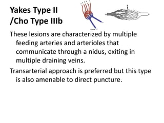 Yakes Type II
/Cho Type IIIb
These lesions are characterized by multiple
feeding arteries and arterioles that
communicate through a nidus, exiting in
multiple draining veins.
Transarterial approach is preferred but this type
is also amenable to direct puncture.
 
