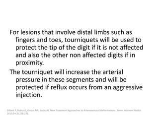 For lesions that involve distal limbs such as
fingers and toes, tourniquets will be used to
protect the tip of the digit if it is not affected
and also the other non affected digits if in
proximity.
The tourniquet will increase the arterial
pressure in these segments and will be
protected if reflux occurs from an aggressive
injection.
Gilbert P, Dubois J, Giroux MF, Soulez G. New Treatment Approaches to Arteriovenous Malformations. Semin Intervent Radiol.
2017;34(3):258-271.
 