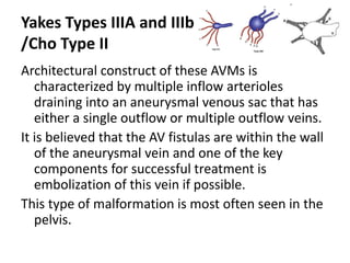 Yakes Types IIIA and IIIb
/Cho Type II
Architectural construct of these AVMs is
characterized by multiple inflow arterioles
draining into an aneurysmal venous sac that has
either a single outflow or multiple outflow veins.
It is believed that the AV fistulas are within the wall
of the aneurysmal vein and one of the key
components for successful treatment is
embolization of this vein if possible.
This type of malformation is most often seen in the
pelvis.
 