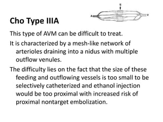 Cho Type IIIA
This type of AVM can be difficult to treat.
It is characterized by a mesh-like network of
arterioles draining into a nidus with multiple
outflow venules.
The difficulty lies on the fact that the size of these
feeding and outflowing vessels is too small to be
selectively catheterized and ethanol injection
would be too proximal with increased risk of
proximal nontarget embolization.
 