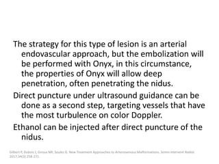 The strategy for this type of lesion is an arterial
endovascular approach, but the embolization will
be performed with Onyx, in this circumstance,
the properties of Onyx will allow deep
penetration, often penetrating the nidus.
Direct puncture under ultrasound guidance can be
done as a second step, targeting vessels that have
the most turbulence on color Doppler.
Ethanol can be injected after direct puncture of the
nidus.
Gilbert P, Dubois J, Giroux MF, Soulez G. New Treatment Approaches to Arteriovenous Malformations. Semin Intervent Radiol.
2017;34(3):258-271.
 