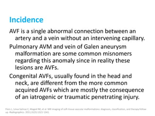 Incidence
AVF is a single abnormal connection between an
artery and a vein without an intervening capillary.
Pulmonary AVM and vein of Galen aneurysm
malformation are some common misnomers
regarding this anomaly since in reality these
lesions are AVFs.
Congenital AVFs, usually found in the head and
neck, are different from the more common
acquired AVFs which are mostly the consequence
of an iatrogenic or traumatic penetrating injury.
Flors L, Leiva-Salinas C, Maged IM, et al. MR imaging of soft-tissue vascular malformations: diagnosis, classification, and therapy follow-
up. Radiographics. 2011;31(5):1321-1341.
 