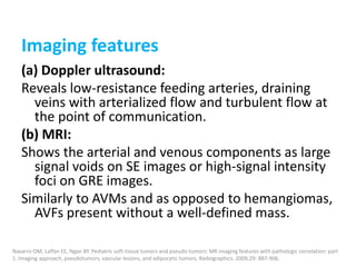 Imaging features
(a) Doppler ultrasound:
Reveals low-resistance feeding arteries, draining
veins with arterialized flow and turbulent flow at
the point of communication.
(b) MRI:
Shows the arterial and venous components as large
signal voids on SE images or high-signal intensity
foci on GRE images.
Similarly to AVMs and as opposed to hemangiomas,
AVFs present without a well-defined mass.
Navarro OM, Laffan EE, Ngan BY. Pediatric soft-tissue tumors and pseudo-tumors: MR imaging features with pathologic correlation: part
1. Imaging approach, pseudotumors, vascular lesions, and adipocytic tumors. Radiographics. 2009;29: 887-906.
 
