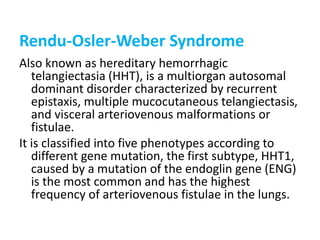 Rendu-Osler-Weber Syndrome
Also known as hereditary hemorrhagic
telangiectasia (HHT), is a multiorgan autosomal
dominant disorder characterized by recurrent
epistaxis, multiple mucocutaneous telangiectasis,
and visceral arteriovenous malformations or
fistulae.
It is classified into five phenotypes according to
different gene mutation, the first subtype, HHT1,
caused by a mutation of the endoglin gene (ENG)
is the most common and has the highest
frequency of arteriovenous fistulae in the lungs.
 