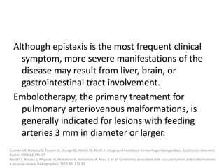 Although epistaxis is the most frequent clinical
symptom, more severe manifestations of the
disease may result from liver, brain, or
gastrointestinal tract involvement.
Embolotherapy, the primary treatment for
pulmonary arteriovenous malformations, is
generally indicated for lesions with feeding
arteries 3 mm in diameter or larger.
Carette MF, Nedelcu C, Tassart M, Grange JD, Wislez M, Khalil A. Imaging of hereditary hemorrhagic telangiectasia. Cardiovasc Intervent
Radiol. 2009;32:745-57
Nozaki T, Nosaka S, Miyazaki O, Makidono A, Yamamoto A, Niwa T, et al. Syndromes associated with vascular tumors and malformations:
a pictorial review. Radiographics. 2013;33: 175-95
 