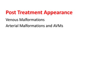 Post Treatment Appearance
Venous Malformations
Arterial Malformations and AVMs
 