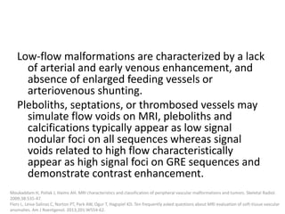Low-flow malformations are characterized by a lack
of arterial and early venous enhancement, and
absence of enlarged feeding vessels or
arteriovenous shunting.
Pleboliths, septations, or thrombosed vessels may
simulate flow voids on MRI, pleboliths and
calcifications typically appear as low signal
nodular foci on all sequences whereas signal
voids related to high flow characteristically
appear as high signal foci on GRE sequences and
demonstrate contrast enhancement.
Moukaddam H, Pollak J, Haims AH. MRI characteristics and classification of peripheral vascular malformations and tumors. Skeletal Radiol.
2009;38:535-47.
Flors L, Leiva-Salinas C, Norton PT, Park AW, Ogur T, Hagspiel KD. Ten frequently asked questions about MRI evaluation of soft-tissue vascular
anomalies. Am J Roentgenol. 2013;201:W554-62.
 