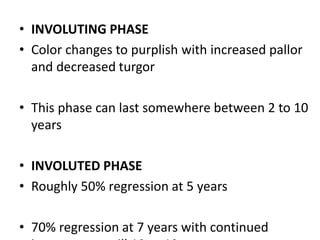 • INVOLUTING PHASE
• Color changes to purplish with increased pallor
and decreased turgor
• This phase can last somewhere between 2 to 10
years
• INVOLUTED PHASE
• Roughly 50% regression at 5 years
• 70% regression at 7 years with continued
 