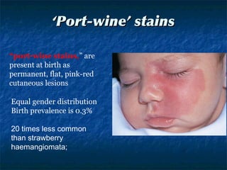 ‘‘Port-wine’ stainsPort-wine’ stains
Equal gender distribution
Birth prevalence is 0.3%
20 times less common
than strawberry
haemangiomata;
“port-wine stains,” are
present at birth as
permanent, flat, pink-red
cutaneous lesions
 