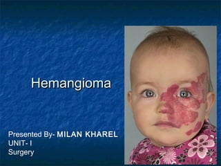 HemangiomaHemangioma
Presented By- MILAN KHAREL
UNIT- I
Surgery
 