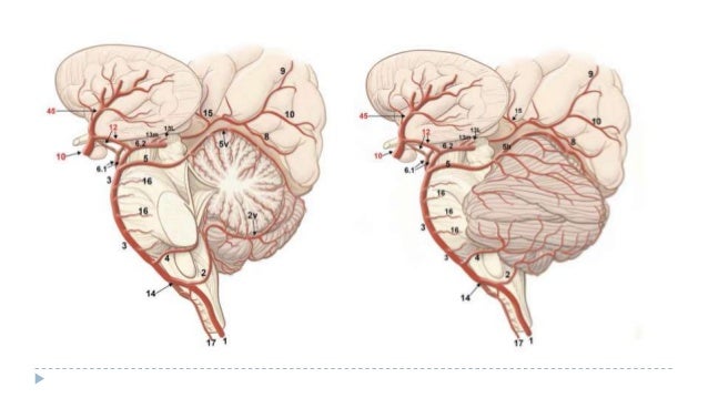 aica and pica syndrome