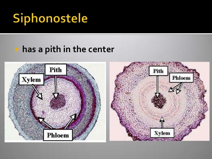 Vascular Cryptogams Postlab