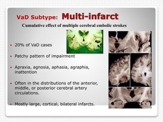 VaD Subtype:
 20% of VaD cases
 Patchy pattern of impairment
 Apraxia, agnosia, aphasia, agraphia,
inattention
 Often in the distributions of the anterior,
middle, or posterior cerebral artery
circulations.
 Mostly large, cortical, bilateral infarcts.
Cumulative effect of multiple cerebral embolic strokes
 
