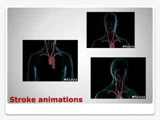 Stroke animations
 