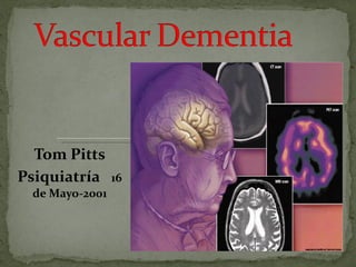 Tom Pitts Psiquiatría  16 de Mayo-2001 