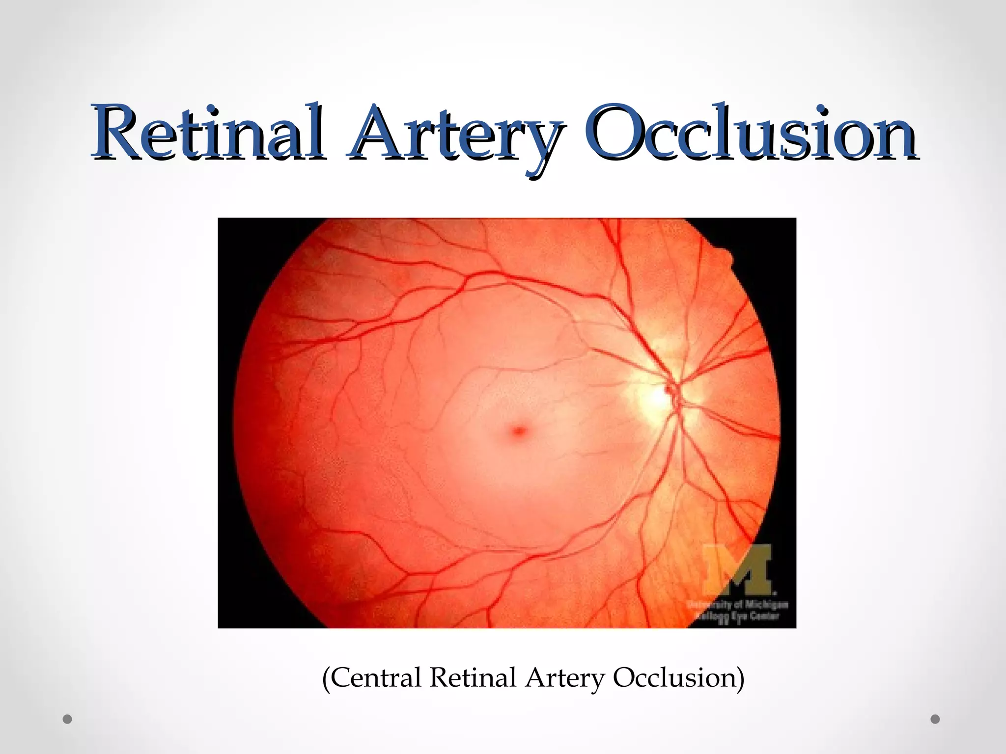 Retinal Artery OcclusionRetinal Artery Occlusion
(Central Retinal Artery Occlusion)
 