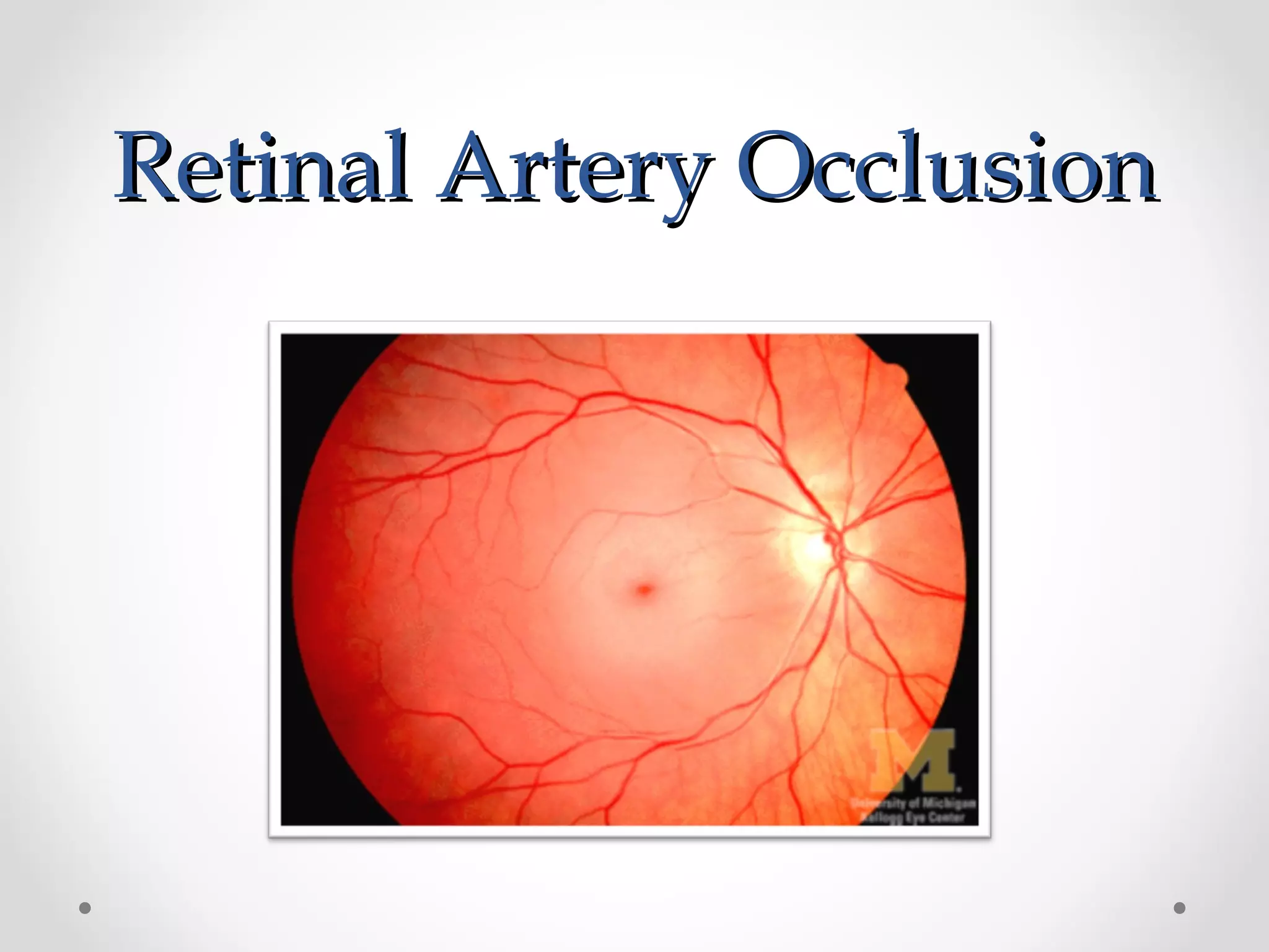 Retinal Artery OcclusionRetinal Artery Occlusion
 