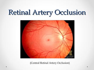 Some Vascular disorders of retina | PPT