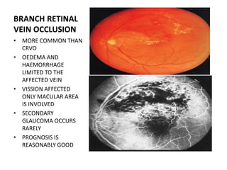 Vascular disorders of retina | PPTX