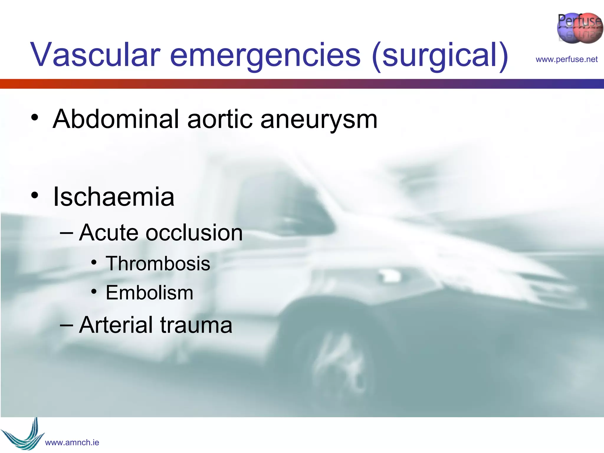 Vascular emergencies tcd sjh 2017 | PPT