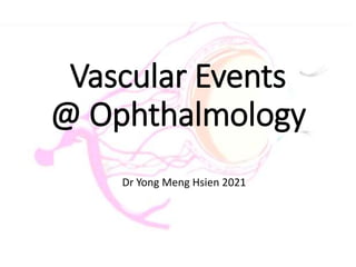 Vascular Events
@ Ophthalmology
Dr Yong Meng Hsien 2021
 