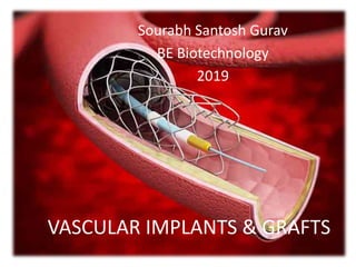 VASCULAR IMPLANTS & GRAFTS
Sourabh Santosh Gurav
BE Biotechnology
2019
 