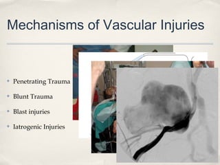 Mechanisms of Vascular Injuries 
✤ Penetrating Trauma 
✤ Blunt Trauma 
✤ Blast injuries 
✤ Iatrogenic Injuries 
 