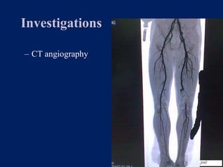 Vascular injuries and Principles of management 2021 | PPT