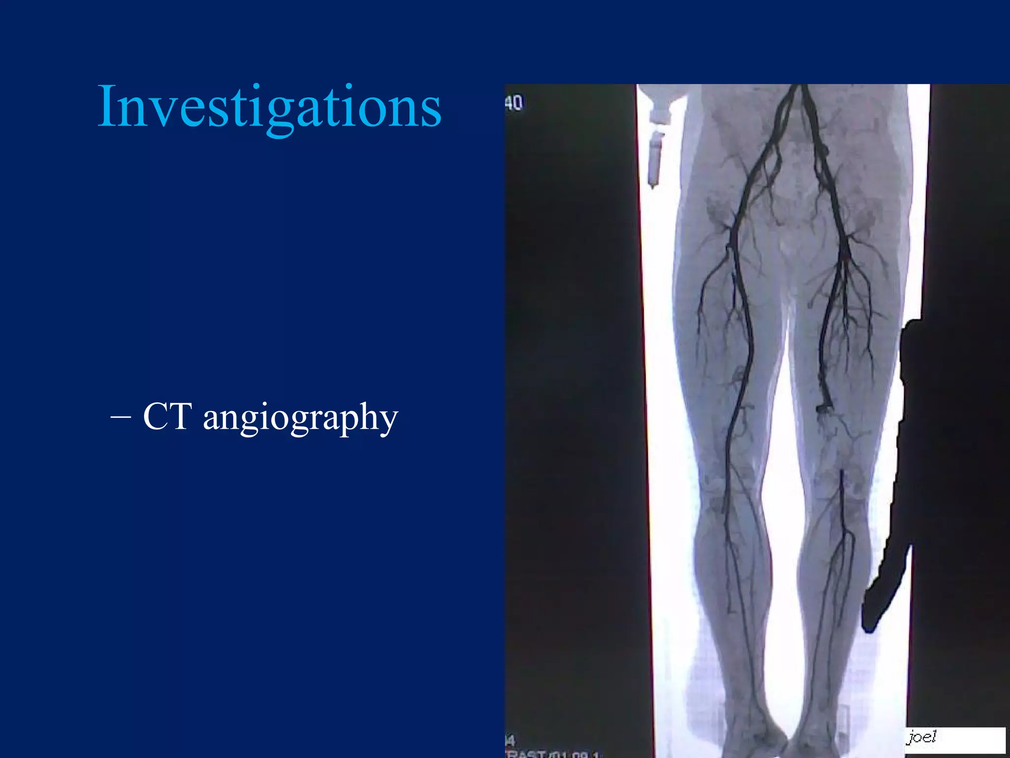 Vascular injuries and management 2018 | PPT