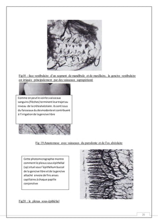 26
Fig18 : face vestibulaire d’un segment de mandibule et de maxillaire, la gencive vestibulaire
est irriguée principalement par des vaisseaux suprapériosté
Fig 19:Anastomose avec vaisseaux du parodonte et de l’os alvéolaire
Fig20 : le plexus sous-épithélial
Comme onpeutle voirlesvaisseaux
sanguins(flèches) terminentleurtrajetau
niveau de lacrétealvéolaire .ilssontissus
du faisseaux dudesmodonteet contribuent
à l’irrigationde lagencive libre
Cette photomicrographie montre
commentle plexussousépithélial
(sp) situé sousl’épithéliumbuccal
de la gencive libre etde la gencive
attaché envoie de finsanses
capillairesàchaque papille
conjonctive
 