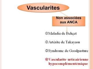 Vascularites
Non associées
aux ANCA
 