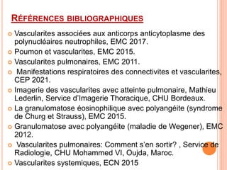 RÉFÉRENCES BIBLIOGRAPHIQUES
 Vascularites associées aux anticorps anticytoplasme des
polynucléaires neutrophiles, EMC 2017.
 Poumon et vascularites, EMC 2015.
 Vascularites pulmonaires, EMC 2011.
 Manifestations respiratoires des connectivites et vascularites,
CEP 2021.
 Imagerie des vascularites avec atteinte pulmonaire, Mathieu
Lederlin, Service d’Imagerie Thoracique, CHU Bordeaux.
 La granulomatose éosinophilique avec polyangéite (syndrome
de Churg et Strauss), EMC 2015.
 Granulomatose avec polyangéite (maladie de Wegener), EMC
2012.
 Vascularites pulmonaires: Comment s’en sortir? , Service de
Radiologie, CHU Mohammed VI, Oujda, Maroc.
 Vascularites systemiques, ECN 2015
 