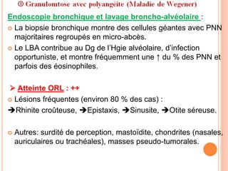 Endoscopie bronchique et lavage broncho-alvéolaire :
 La biopsie bronchique montre des cellules géantes avec PNN
majoritaires regroupés en micro-abcès.
 Le LBA contribue au Dg de l’Hgie alvéolaire, d’infection
opportuniste, et montre fréquemment une ↑ du % des PNN et
parfois des éosinophiles.
 Atteinte ORL : ++
 Lésions fréquentes (environ 80 % des cas) :
Rhinite croûteuse, Epistaxis, Sinusite, Otite séreuse.
 Autres: surdité de perception, mastoïdite, chondrites (nasales,
auriculaires ou trachéales), masses pseudo-tumorales.
 