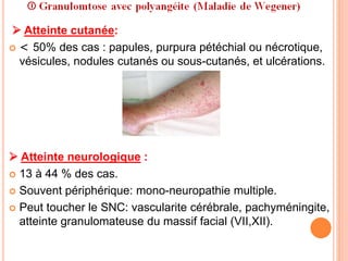  Atteinte cutanée:
 < 50% des cas : papules, purpura pétéchial ou nécrotique,
vésicules, nodules cutanés ou sous-cutanés, et ulcérations.
 Atteinte neurologique :
 13 à 44 % des cas.
 Souvent périphérique: mono-neuropathie multiple.
 Peut toucher le SNC: vascularite cérébrale, pachyméningite,
atteinte granulomateuse du massif facial (VII,XII).
 