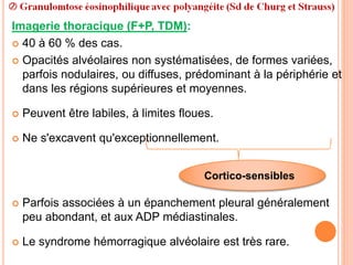 Imagerie thoracique (F+P, TDM):
 40 à 60 % des cas.
 Opacités alvéolaires non systématisées, de formes variées,
parfois nodulaires, ou diffuses, prédominant à la périphérie et
dans les régions supérieures et moyennes.
 Peuvent être labiles, à limites floues.
 Ne s'excavent qu'exceptionnellement.
 Parfois associées à un épanchement pleural généralement
peu abondant, et aux ADP médiastinales.
 Le syndrome hémorragique alvéolaire est très rare.
Cortico-sensibles
 