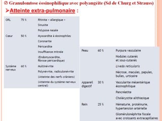 Atteinte extra-pulmonaire :
 