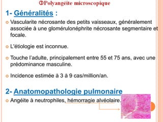 1- Généralités :
 Vascularite nécrosante des petits vaisseaux, généralement
associée à une glomérulonéphrite nécrosante segmentaire et
focale.
 L'étiologie est inconnue.
 Touche l’adulte, principalement entre 55 et 75 ans, avec une
prédominance masculine.
 Incidence estimée à 3 à 9 cas/million/an.
2- Anatomopathologie pulmonaire
 Angéite à neutrophiles, hémorragie alvéolaire.
 
