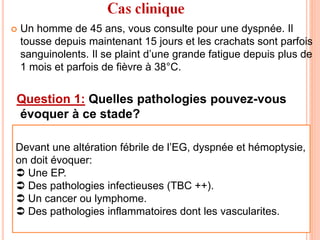  Un homme de 45 ans, vous consulte pour une dyspnée. Il
tousse depuis maintenant 15 jours et les crachats sont parfois
sanguinolents. Il se plaint d’une grande fatigue depuis plus de
1 mois et parfois de fièvre à 38°C.
Question 1: Quelles pathologies pouvez-vous
évoquer à ce stade?
Devant une altération fébrile de l’EG, dyspnée et hémoptysie,
on doit évoquer:
 Une EP.
 Des pathologies infectieuses (TBC ++).
 Un cancer ou lymphome.
 Des pathologies inflammatoires dont les vascularites.
 