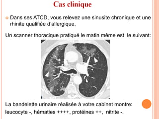  Dans ses ATCD, vous relevez une sinusite chronique et une
rhinite qualifiée d’allergique.
Un scanner thoracique pratiqué le matin même est le suivant:
La bandelette urinaire réalisée à votre cabinet montre:
leucocyte -, hématies ++++, protéines ++, nitrite -.
 