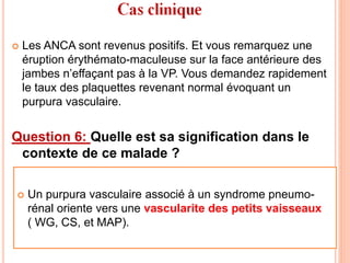  Les ANCA sont revenus positifs. Et vous remarquez une
éruption érythémato-maculeuse sur la face antérieure des
jambes n’effaçant pas à la VP. Vous demandez rapidement
le taux des plaquettes revenant normal évoquant un
purpura vasculaire.
Question 6: Quelle est sa signification dans le
contexte de ce malade ?
 Un purpura vasculaire associé à un syndrome pneumo-
rénal oriente vers une vascularite des petits vaisseaux
( WG, CS, et MAP).
 