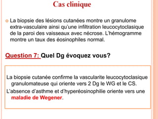  La biopsie des lésions cutanées montre un granulome
extra-vasculaire ainsi qu’une infiltration leucocytoclasique
de la paroi des vaisseaux avec nécrose. L’hémogramme
montre un taux des éosinophiles normal.
Question 7: Quel Dg évoquez vous?
La biopsie cutanée confirme la vascularite leucocytoclasique
granulomateuse qui oriente vers 2 Dg le WG et le CS.
L’absence d’asthme et d’hyperéosinophilie oriente vers une
maladie de Wegener.
 