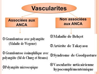 Vascularites
Associées aux
ANCA
Non associées
aux ANCA
 