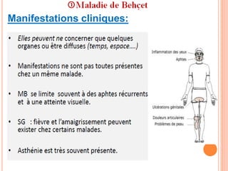 Manifestations cliniques:
 