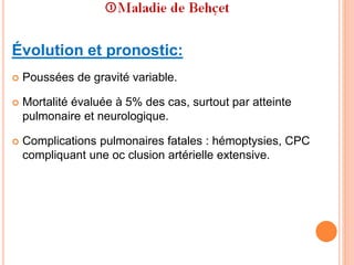 Évolution et pronostic:
 Poussées de gravité variable.
 Mortalité évaluée à 5% des cas, surtout par atteinte
pulmonaire et neurologique.
 Complications pulmonaires fatales : hémoptysies, CPC
compliquant une oc clusion artérielle extensive.
 