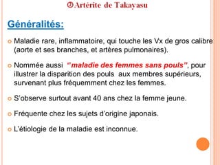 Généralités:
 Maladie rare, inflammatoire, qui touche les Vx de gros calibre
(aorte et ses branches, et artères pulmonaires).
 Nommée aussi ‘’maladie des femmes sans pouls’’, pour
illustrer la disparition des pouls aux membres supérieurs,
survenant plus fréquemment chez les femmes.
 S’observe surtout avant 40 ans chez la femme jeune.
 Fréquente chez les sujets d’origine japonais.
 L’étiologie de la maladie est inconnue.
 