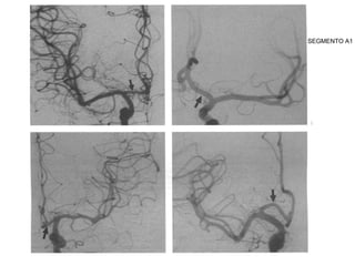SEGMENTO A1
 