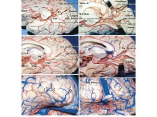 Vascularizacao cerebral