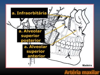 a. Infraorbitária 
a. Alveolar 
superior 
posterior 
a. Alveolar 
superior 
anterior 
Madeira 
 