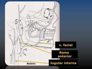 v. facial 
Ramo 
anterior 
Madeira Jugular interna 
 